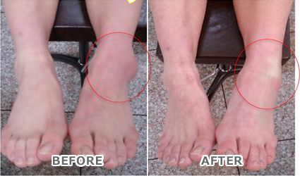 BEFORE AFTER