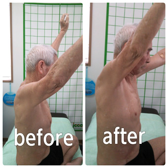 before after